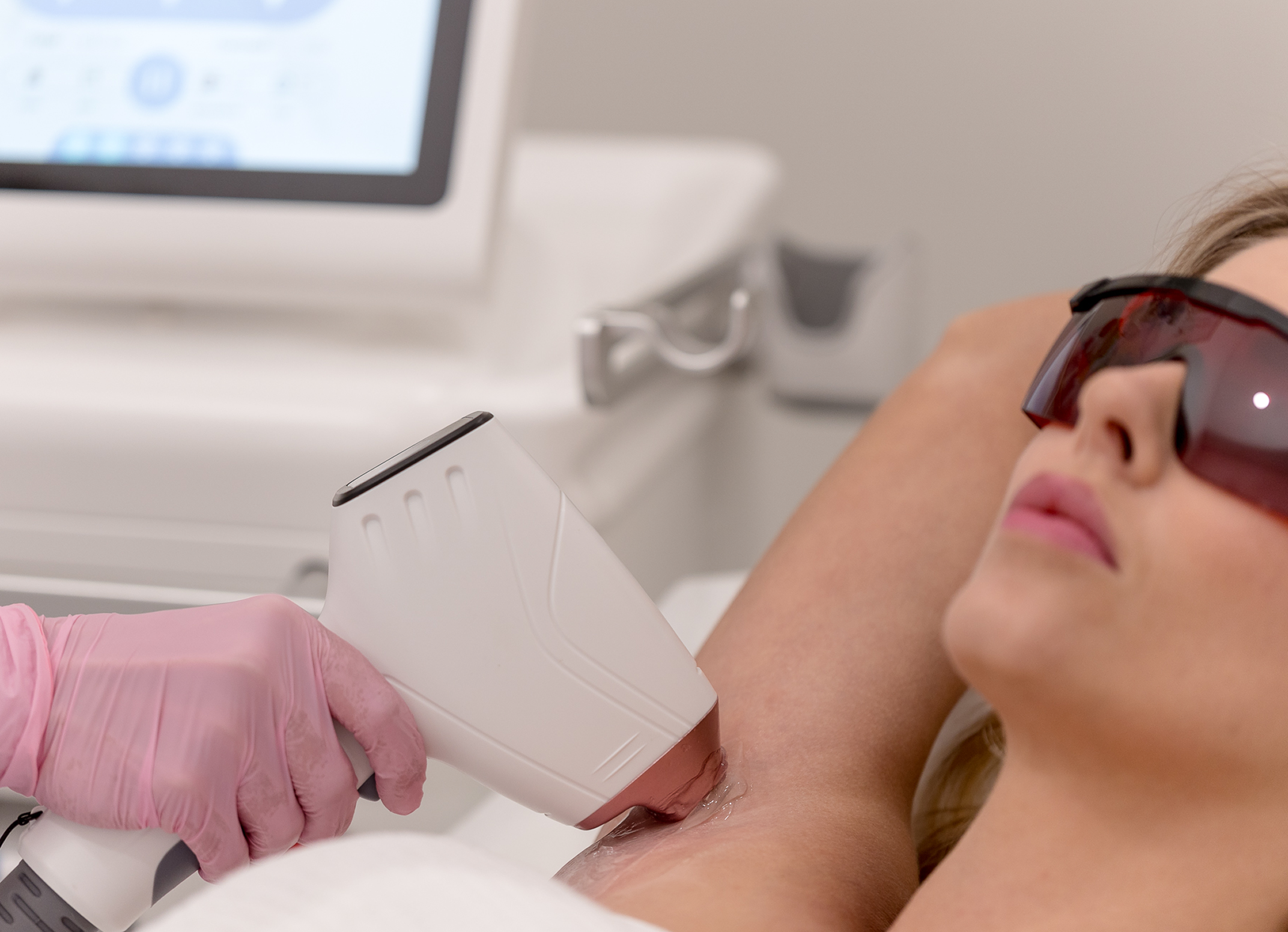 Laser hair removal (LHR)