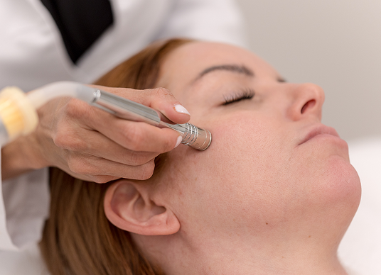 Microdermabrasion